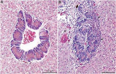 Effects of dietary mycotoxins and mycotoxin adsorbent additives on production performance, hematological parameters, and liver histology in juvenile Nile tilapia (Oreochromis niloticus)